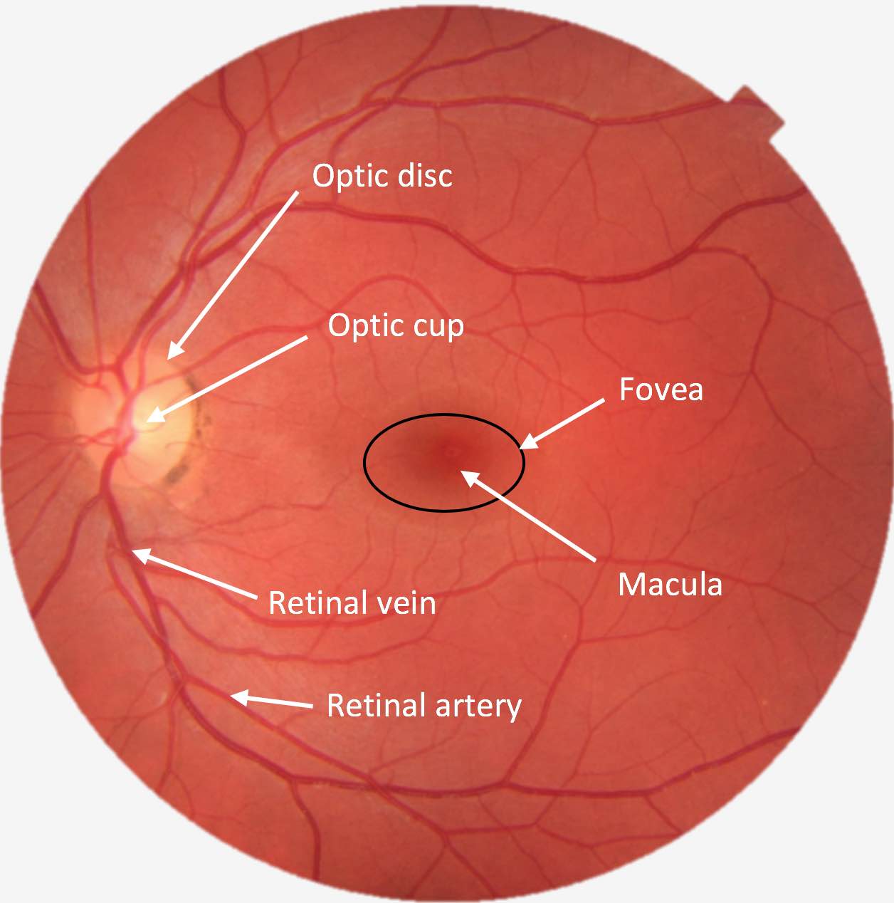 define retina